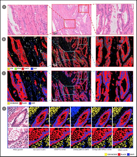 Cellular Biomarker Prediction Results A Hande Stained Colon Cancer