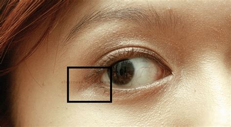 Rash/red skin outer corners of eyes - How do you get rid ...