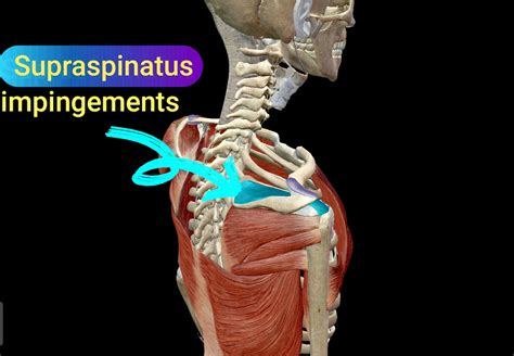 Shoulder Impingement Special Test