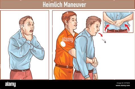 Heimlich Choking Poster Stock Vector Images Alamy