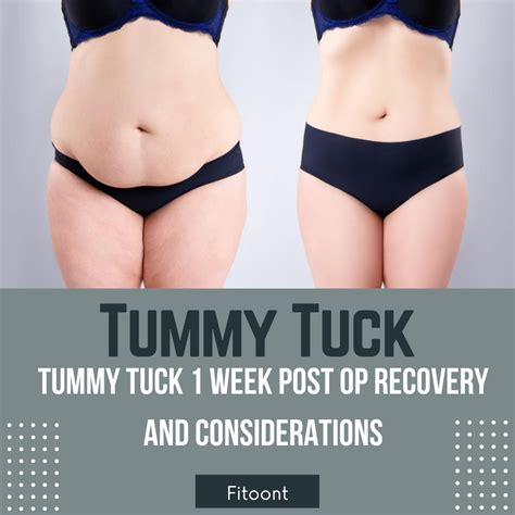 Tummy Tuck 1 Week Post Op Recovery And Considerations Fitoont