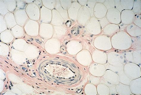 Pathology Outlines Histology White Adipose