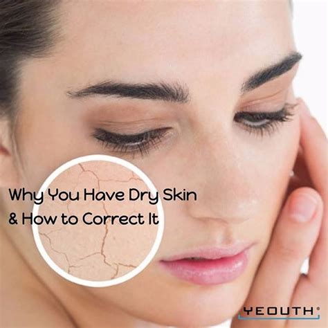 Do You Have Dryskin You Might Find This Surprising But Dry Skin Is