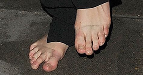 25 Ugly Celebrity Feet Nasty Corns And Hammer Toes
