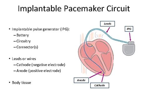 Basics Of Pacemaker Part 1 Dr Suresh S