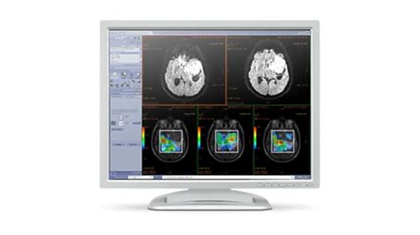 Advantage Workstation For Diagnostic Imaging Ge Healthcare