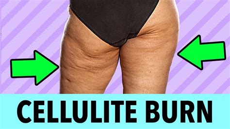 28 day cellulite burn challenge get rid of cellulite on thighs and bum fast youtube