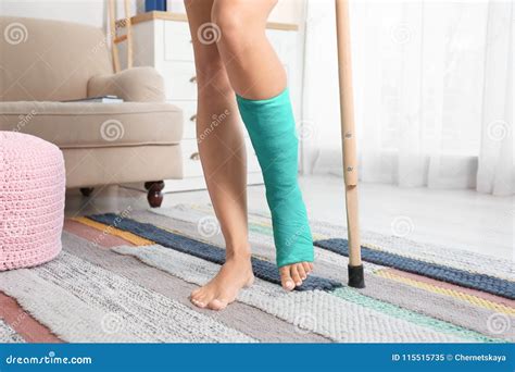 Young Woman With Crutch And Broken Leg In Cast Stock Image Image Of