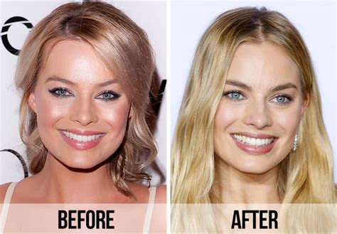 Fans Spot A Huge Difference In Margot Robbies Appearance After Looking At Before And After Photos