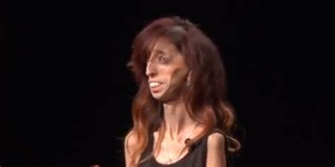 Labeled Worlds Ugliest Woman Motivational Speaker Turns Hate Into