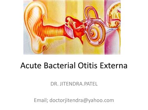Solution Acute Bacterial Otitis Externa Studypool