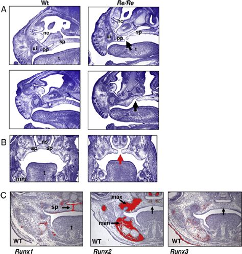 Runx1 Has A Role In The Developing Palate A And B E165 Mouse Embryo
