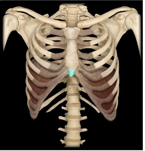 Xiphoid Process Protrusion
