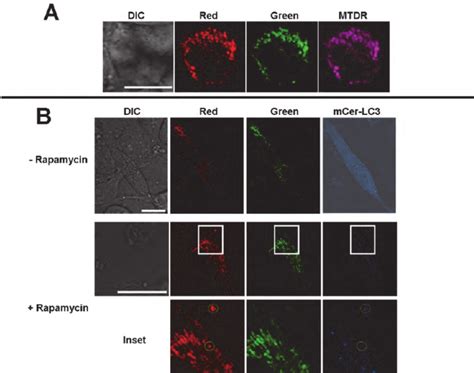 Rosella Can Be Used To Monitor Mitophagy In Mammalian Cells A Dic