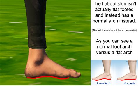 2021 The Flatfoot Skin Doesnt Actually Have Flat Feet Literally