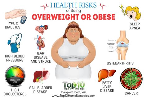 Image Gallery Obesity Health Problems