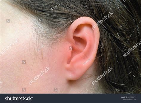 Womans Ear Red Marks Inflammation Health Stock Photo 1839700279