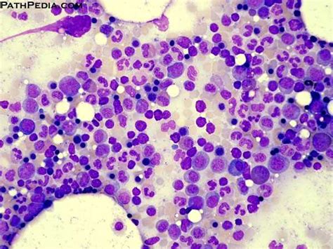 Histology Images Of Bone Marrow By