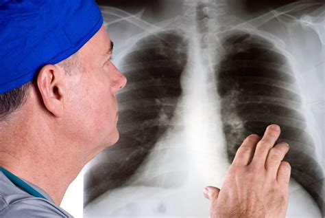 How Lung Cancer Is Diagnosed