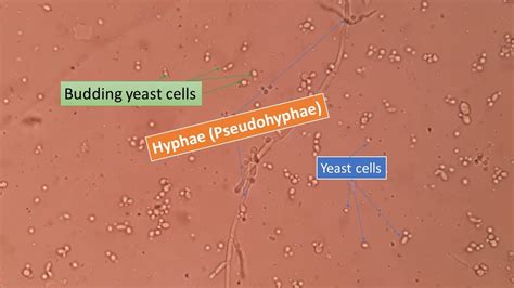 How To Farm Yeast Farm Mania