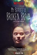 My Beautiful Broken Brain (#2 of 2): Mega Sized Movie Poster Image ...