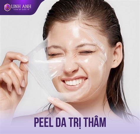 Peel Da Trị Thâm Mụn Là Gì Có An Toàn Và Hiệu Quả Không