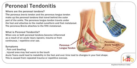 Peroneal Tendonitis Causes Symptoms And Treatment Healthguidance