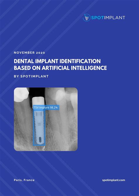 Dental Implant Identification Service Ai Based Spotimplant 60900 Hot Sex Picture