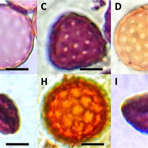 Light Micrographs Showing Equatorial Views Of Pollen Grains Of The
