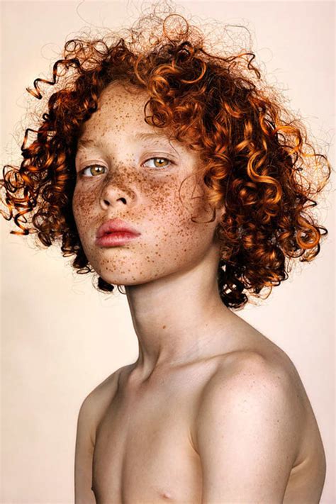 Striking Portraits Of Freckled People By British Photographer