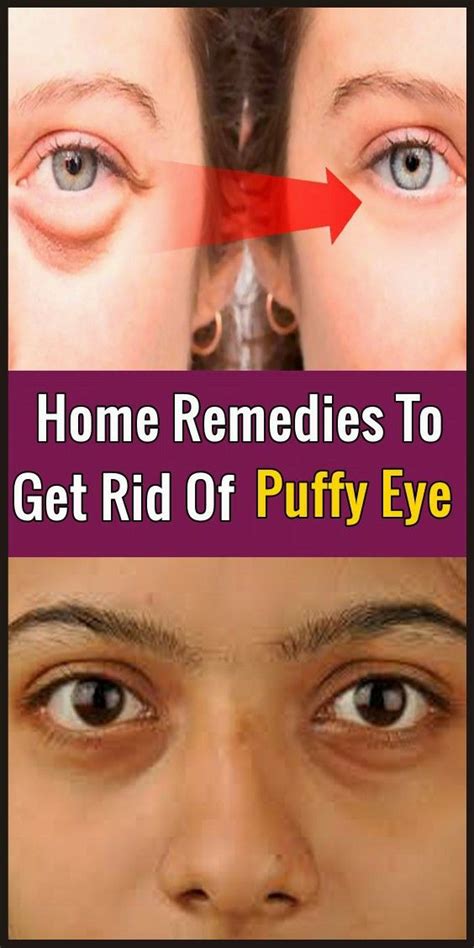 Home Remedies To Get Rid Of Puffy Eye Face Errors Get Rid Of Puffy Eyes Puffy Eyes Puffy