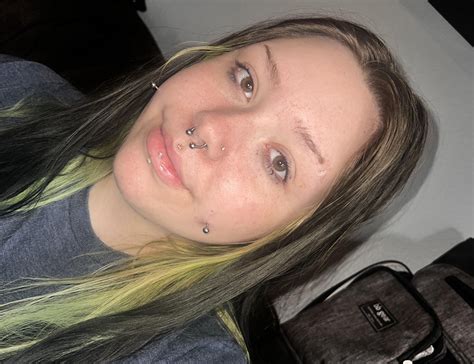 Finally Got My Cheeks Pierced After Years Of Wanting Them Day 2 R Bodymods