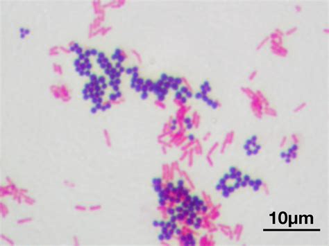 Thick (multilayered) peptidoglycan layer is present in gram positive bacteria. Gram staining - Simple English Wikipedia, the free ...
