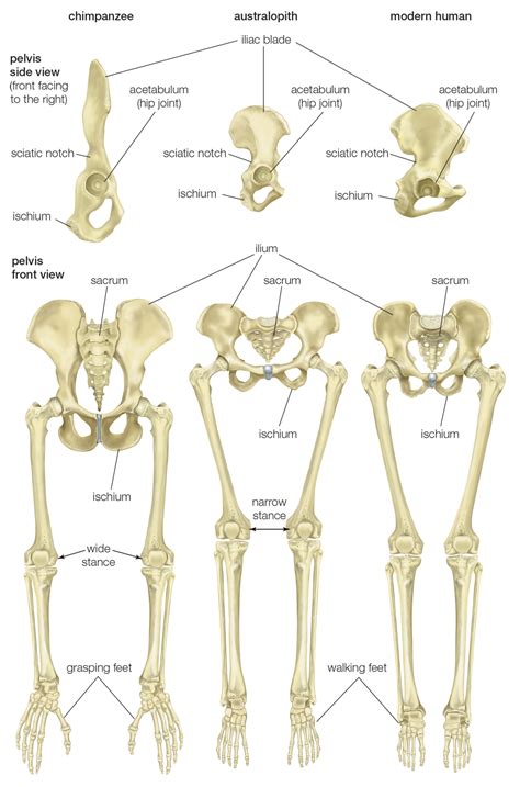 Normal leg bones are relatively straight, but those affected by paget's disease are porous and figure 9. pelvis | Definition, Anatomy, Diagram, & Facts | Britannica