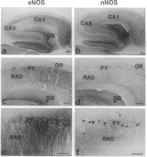 Prominent Immunoreactivity Of Ca1 Hippocampal Pyramidal Neurons For
