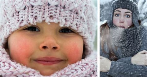 Why Your Cheeks Go Rosy In The Cold And What Else Happens To Your Body When Its Freezing
