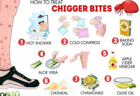 Chigger Bites Pictures Treatment Look Like Home Remedies