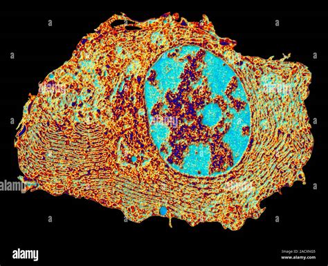 Human Cell Coloured Transmission Electron Micro Graph TEM Of A