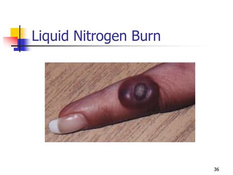 Ppt Safe Handling And Use Of Liquid Nitrogen Powerpoint Presentation