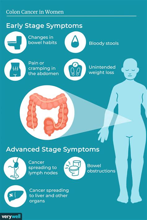 Symptoms Of Colon Cancer In Women