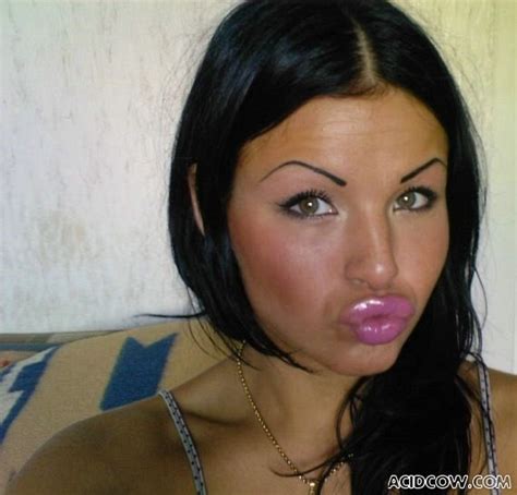 Girls With Silicone Lips Pics