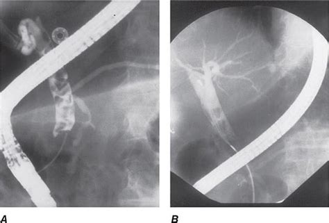 Video Atlas Of Gastrointestinal Endoscopy Basicmedical Key