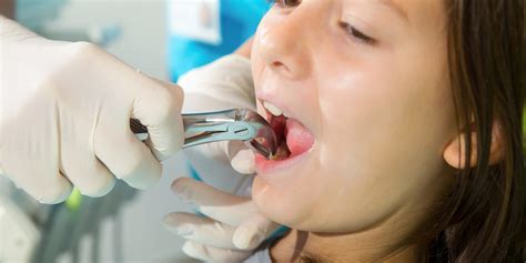 jackson wisdom teeth extractions dental care of jackson hole wy 83001