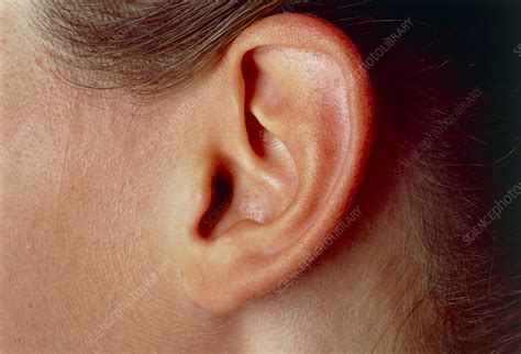 View Of Teenagers Left Ear Pinna Auricle Stock Image P4300061