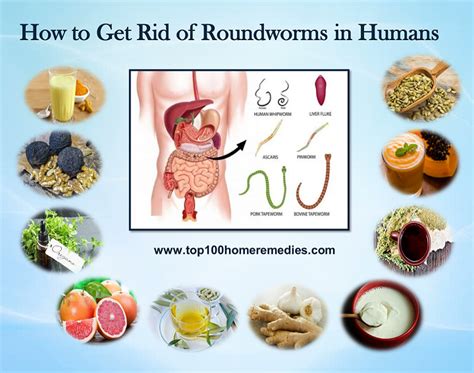 How To Get Rid Of Roundworms In Humans Try 4 And 7 For Effective Result