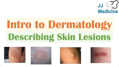 Introduction To Dermatology The Basics Describing Skin Lesions Primary Secondary