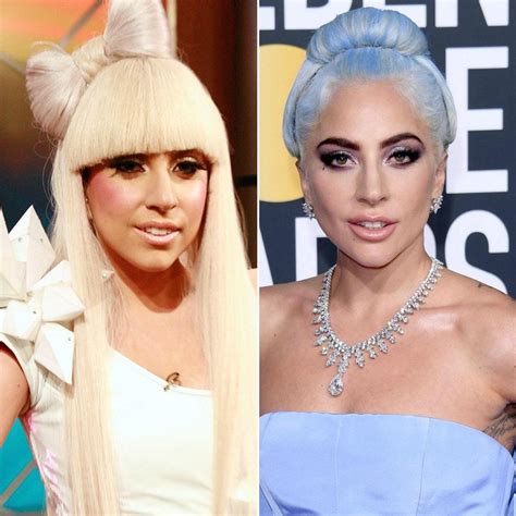 lady gaga nose job before after