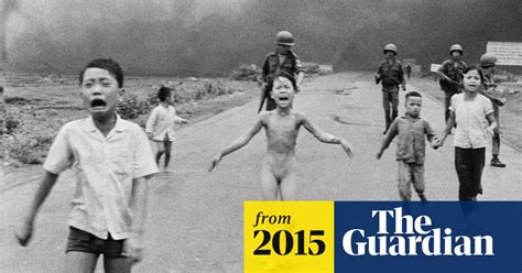 Vietnam War S Napalm Girl Kim Phuc Has Laser Treatment To Heal Wounds Us News The Guardian