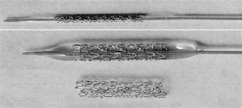 Balloon Expandable Stent A Stent Mounted On A Balloon Angiography