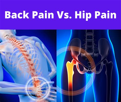 Back Pain Vs Hip Pain Thrive Chiropractic